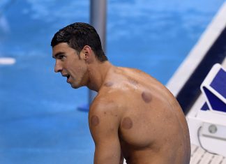 Test Drive: I tried cupping therapy, and I actually liked it Michael Phelps Cupping