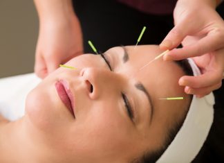 Facial acupuncture is growing in popularity. An Atlanta expert explains the process.