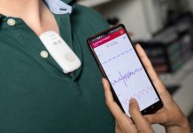 A new monitoring device by a Georgia Tech professor is like “an Apple Watch for your heart”